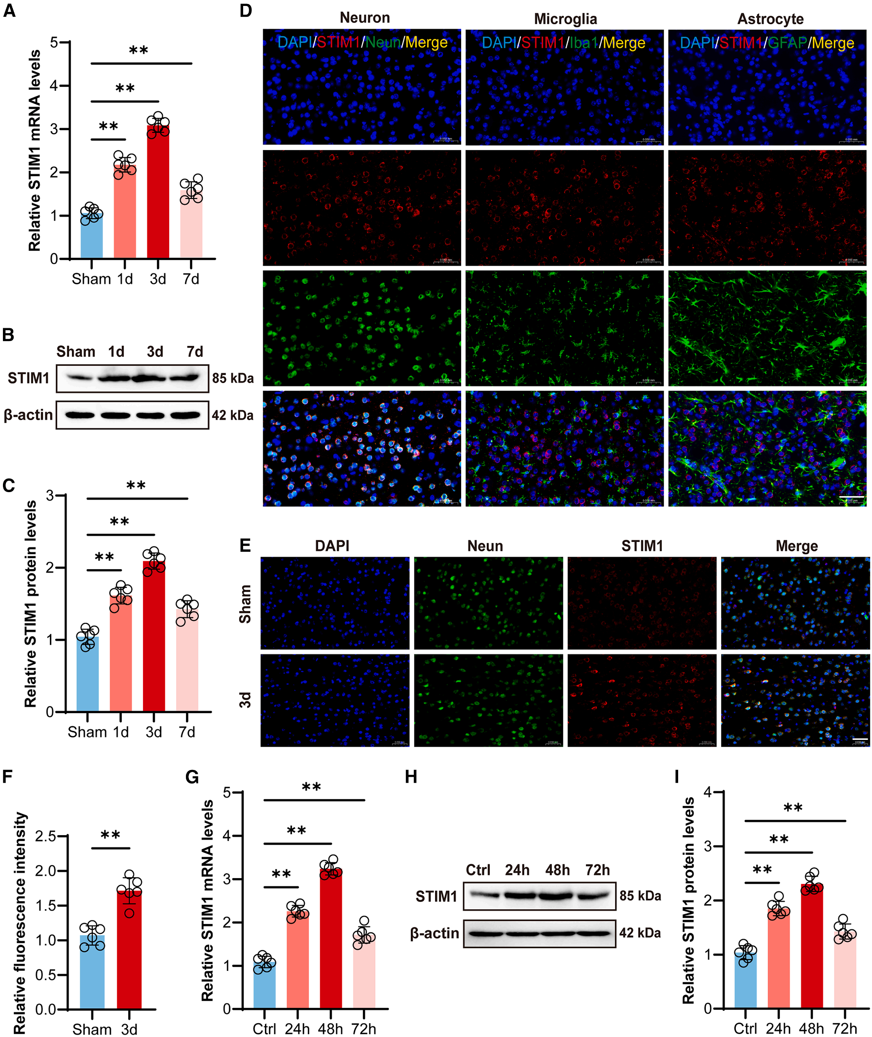 STIM1 regulates iron homeostasis and promotes neuronal ferroptosis to aggravate cerebral hemorrhage